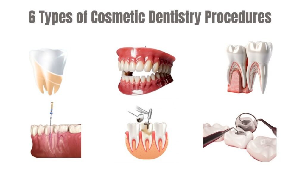 6 Types of Cosmetic Dentistry Procedures