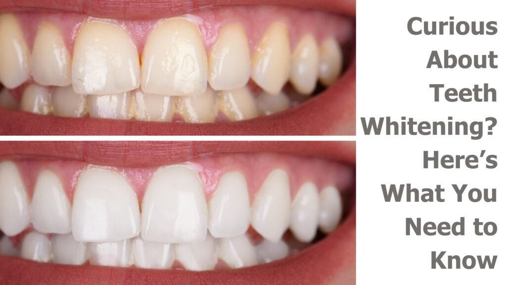 Curious About Teeth Whitening Here’s What You Need to Know